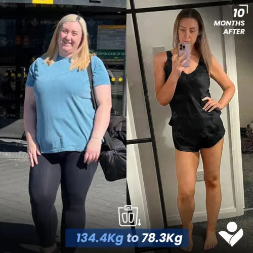 Before and after — Novemedical patient 1