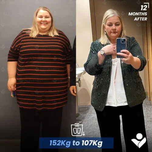 Before and after — Novemedical patient 2