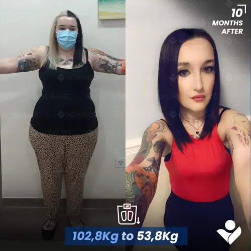Before and after — Novemedical patient 4