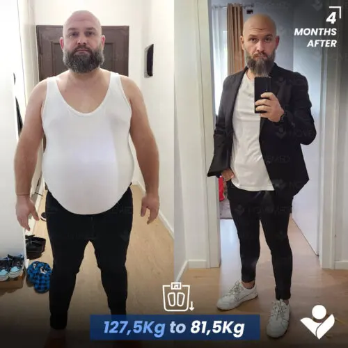 Before and after — Novemedical patient 5