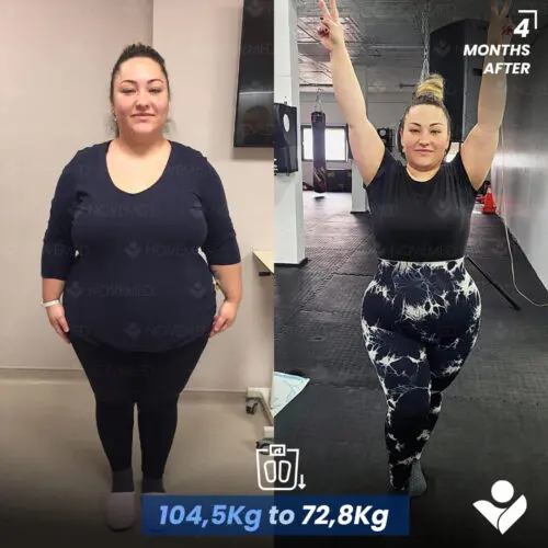 Before and after — Novemedical patient 6