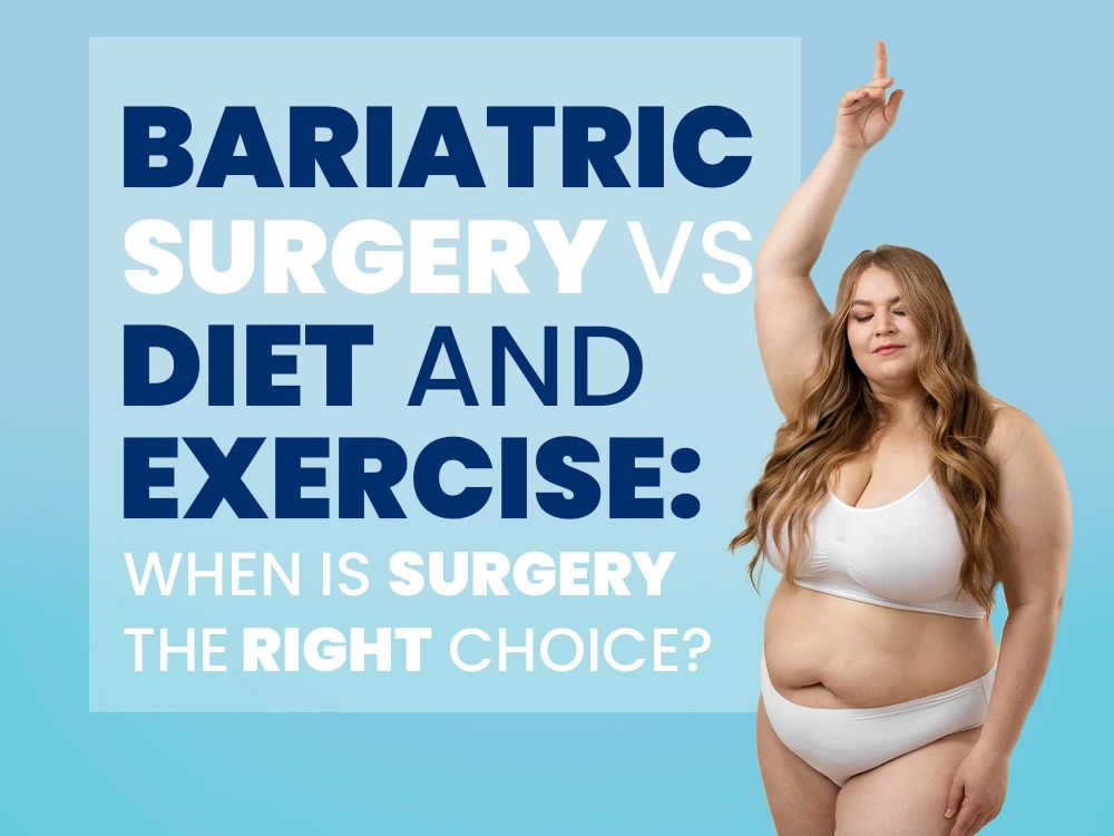 Bariatric surgery vs. diet and exercise — when is surgery the right choice?